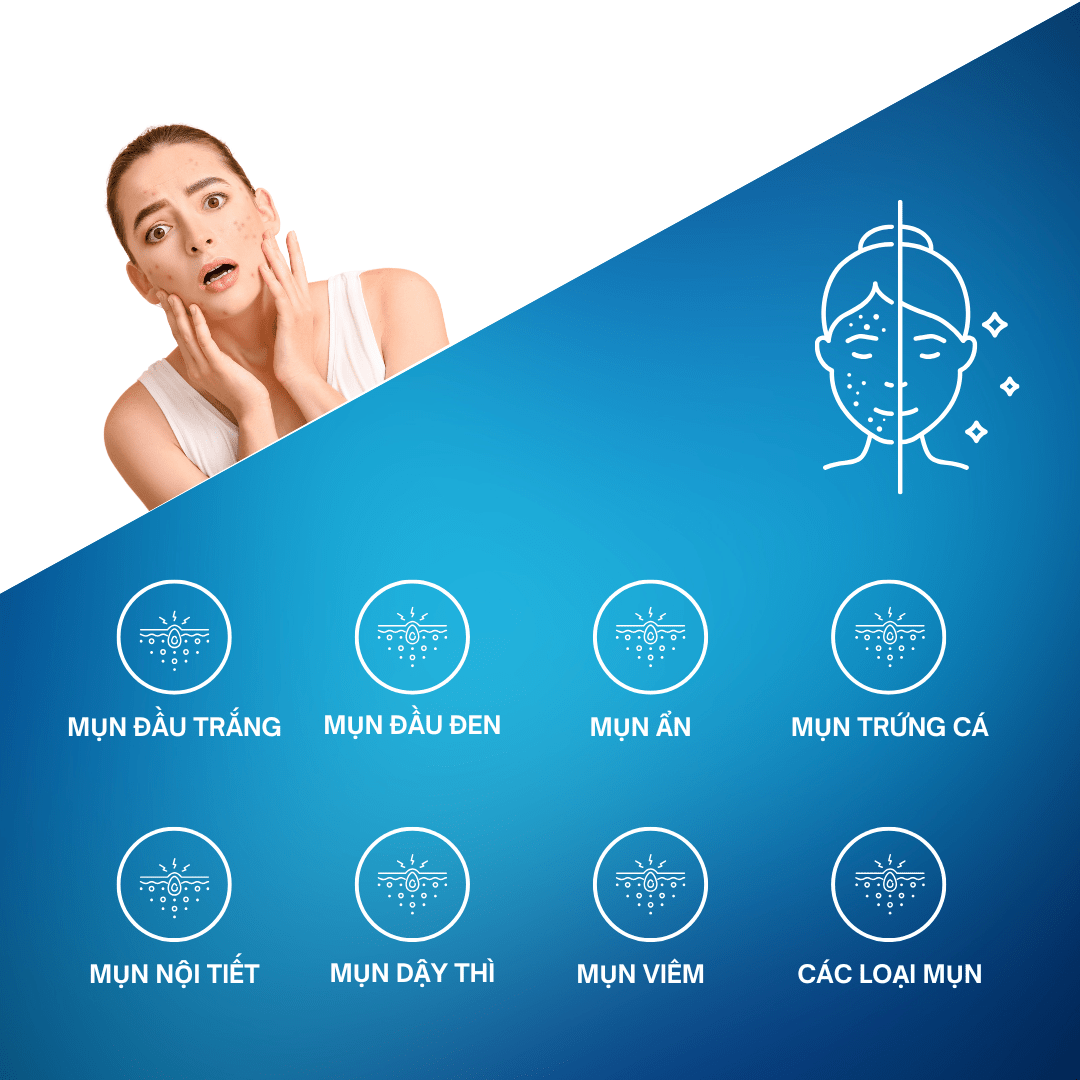 Sữa Rửa Mặt NUSA Dành Cho Da Dầu Mụn (150ml)..