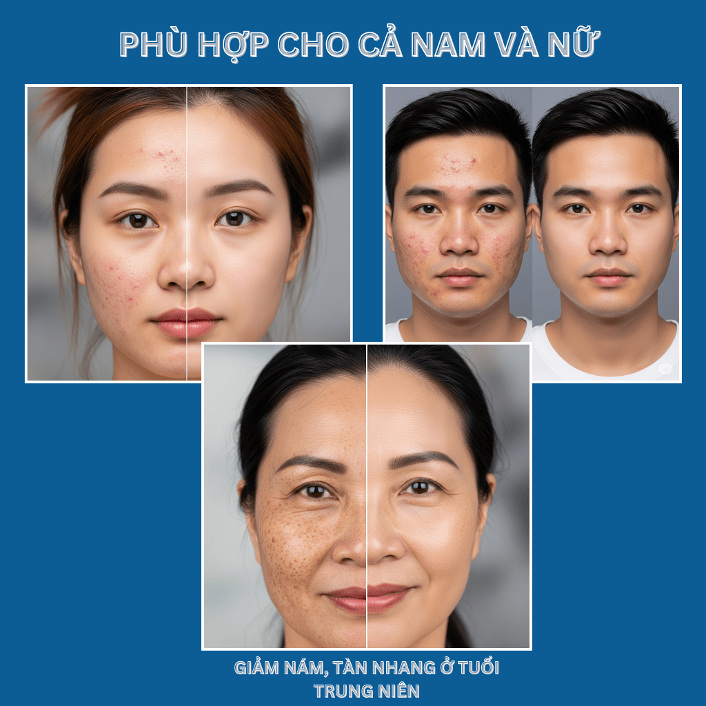 Sữa Rửa Mặt Nusa Lovely Dành Cho Cả Nam & Nữ (150ml)